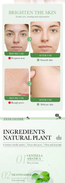 Limpador Facial Centella Asiatica Hidratante Controle de Oleosidade Limpeza Facial Espuma de Lavagem