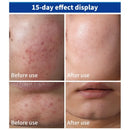 Cicaplast Creme Reparador B5 40ml Creme Super Hidratante