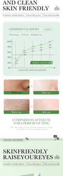 Limpador Facial Centella Asiatica Hidratante Controle de Oleosidade Limpeza Facial Espuma de Lavagem